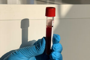 Nzoz Allmed - poradnia hematologiczna dla dzieci
