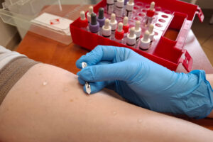 Nzoz Allmed - uslugi-medyczne-testy-alergiczne